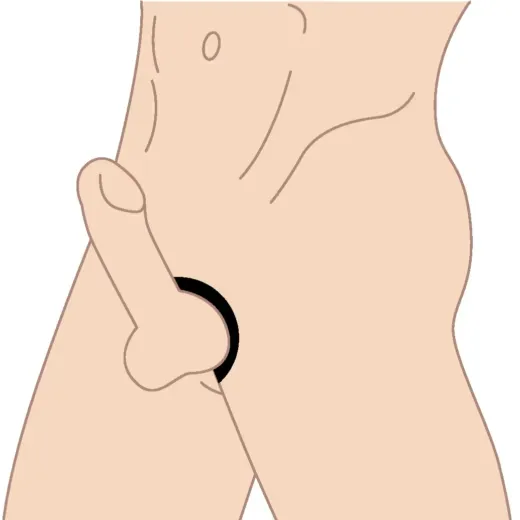 Illustration d'un cockring positionné à la base de la verge et des testicules