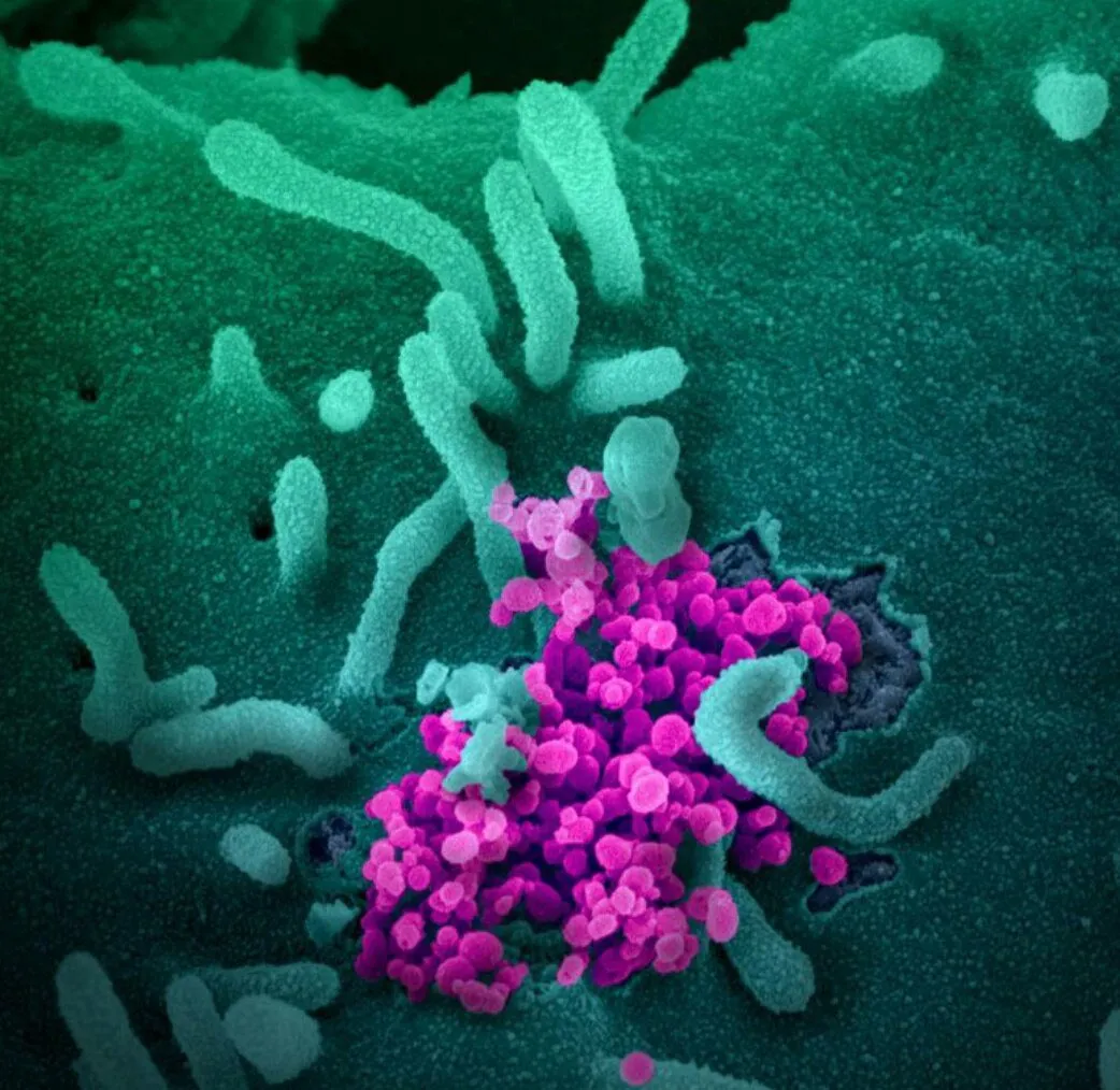 Libertinage et santé sexuelle : à quelle fréquence se faire dépister des IST ?