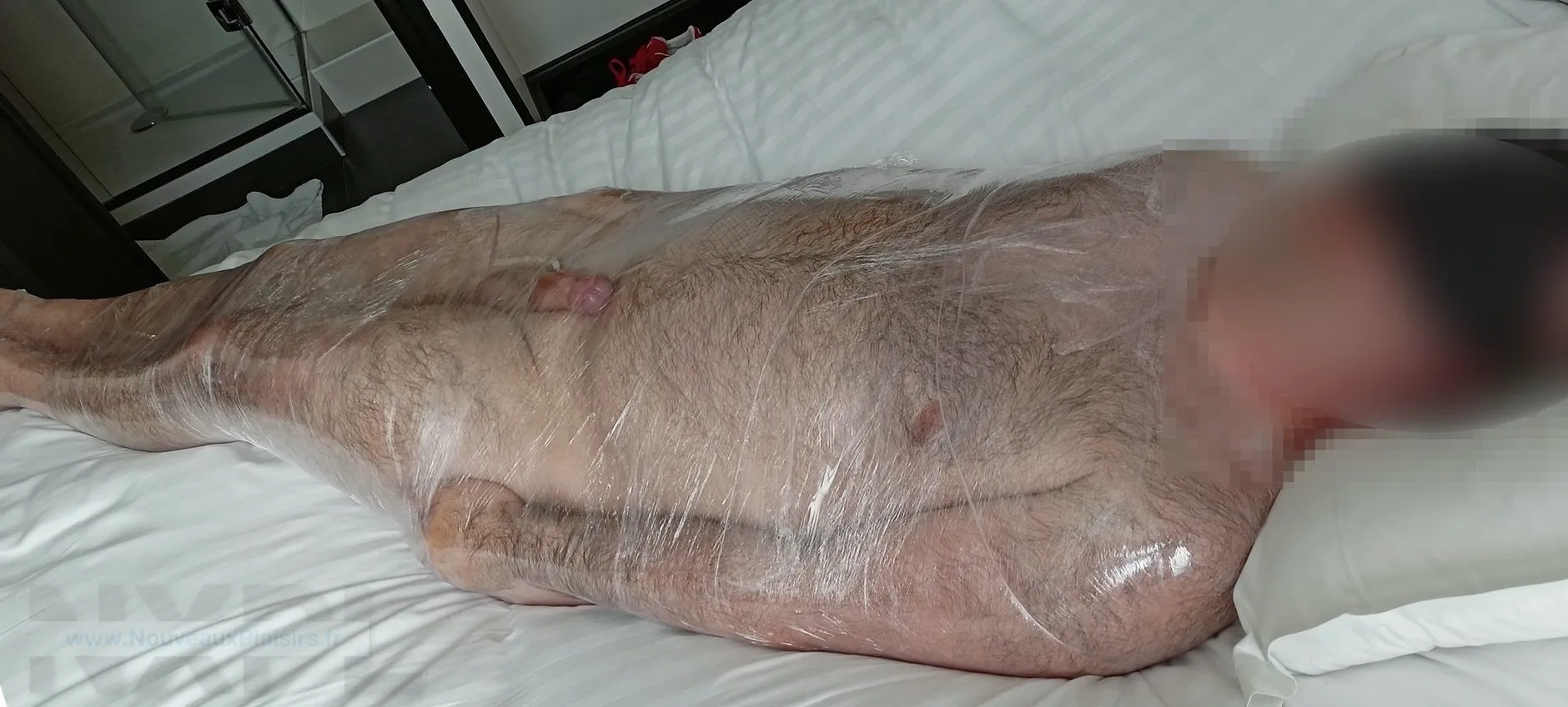 Immobilisation totale par momification plastique