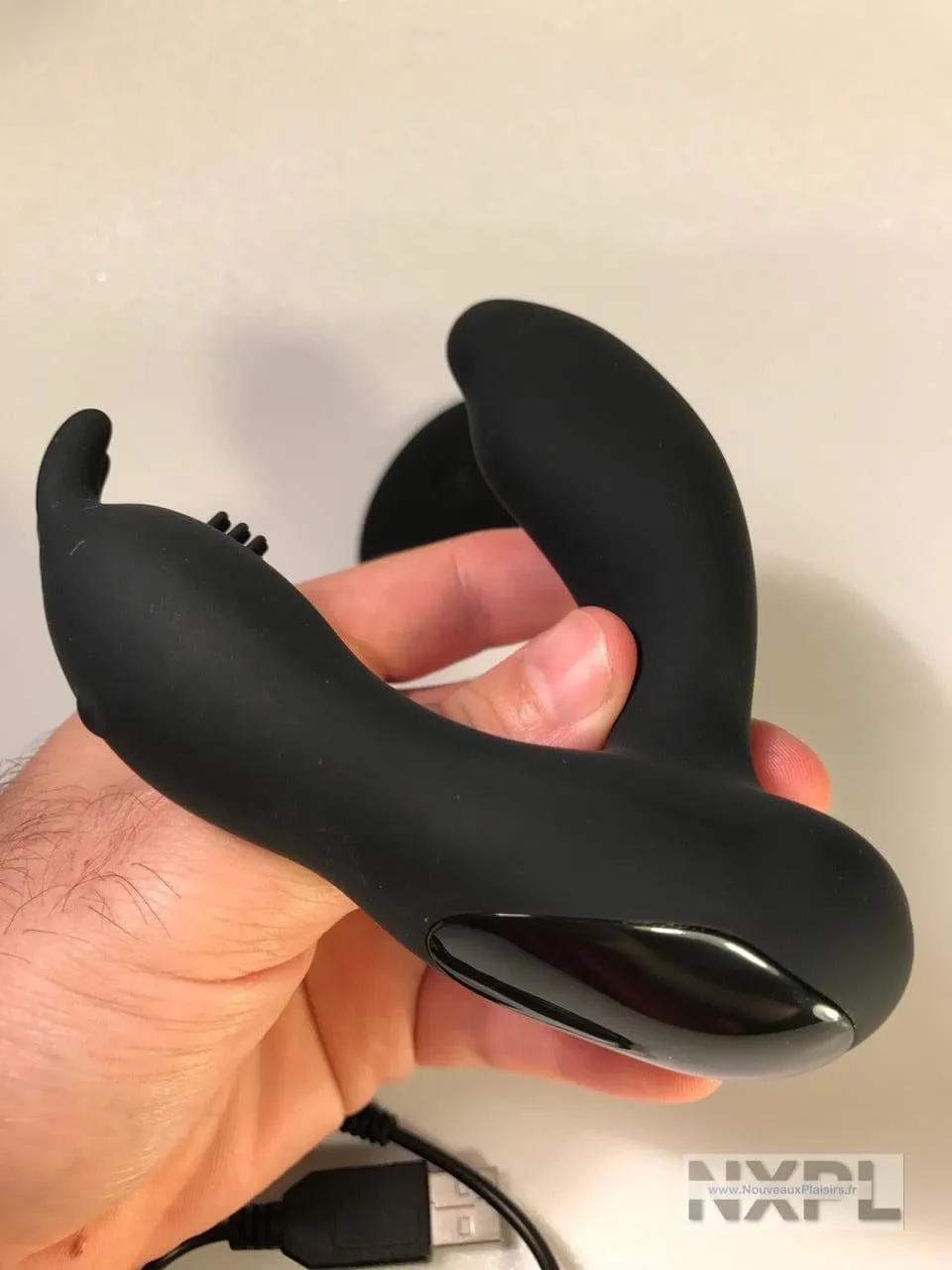 nxpl prostate rabbit 16 e1510264924627