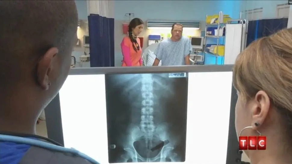 Sextoy visible à la radio